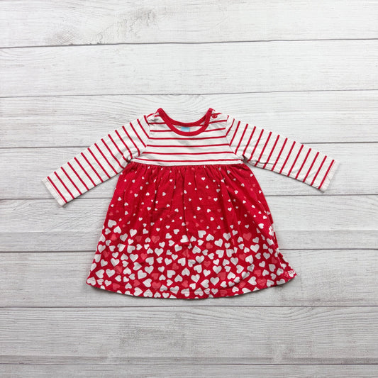 6-12M | Print Dress