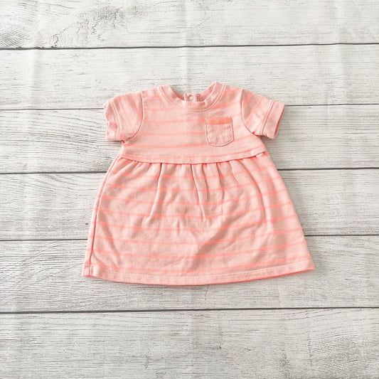 3-6M | Stripe Dress