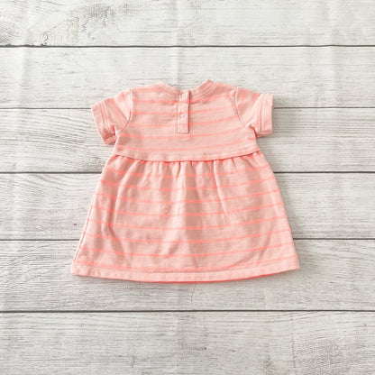3-6M | Stripe Dress